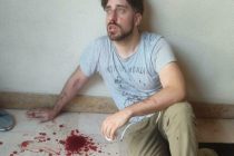 Perseguitato da spacciatori africani, ridotto così in casa sua perché italiano – FOTO