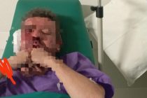 In venti hanno massacrato tre amici italiani: ossa rotte e teste spaccate
