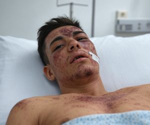 Lorenzo e Alessandro accoltellati dai nuovi ‘italiani’ del PD: uno morto e l’altro in fin di vita