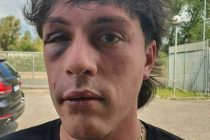 Ridotto così da immigrati che volevano violentare ragazza