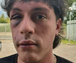 Ridotto così da immigrati che volevano violentare ragazza