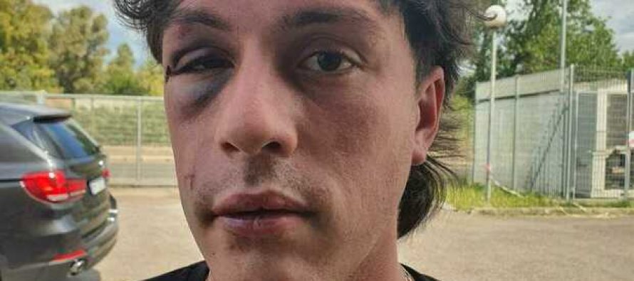 Ridotto così da immigrati che volevano violentare ragazza