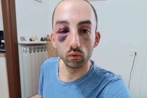 Ridotto così da sei immigrati nordafricani a Varese – FOTO
