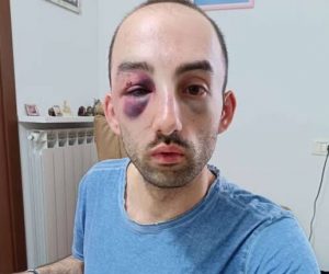 Ridotto così da sei immigrati nordafricani a Varese – FOTO