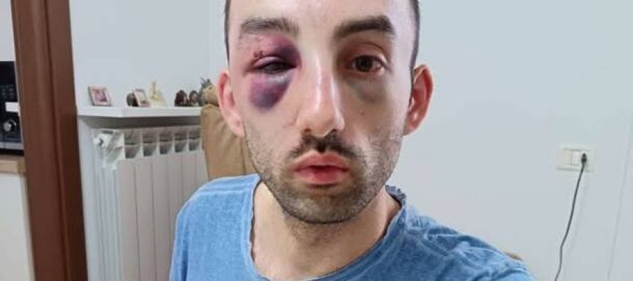 Ridotto così da sei immigrati nordafricani a Varese – FOTO