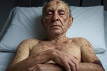 Bastonato a sangue dall’ex badante straniera: gli spezza la schiena