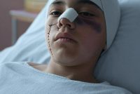 15 maranza massacrano ragazzini italiani: nasi rotti e cornee lesionate