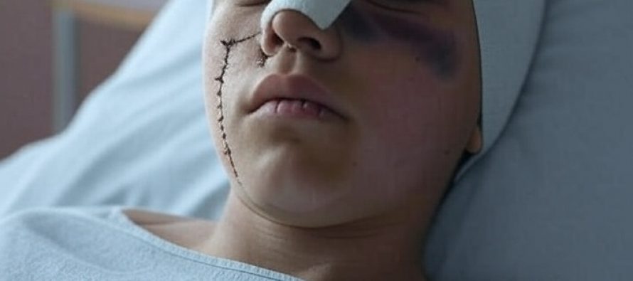 Ondata di ultraviolenza, ragazzini italiai nel mirino dei migranti razzisti