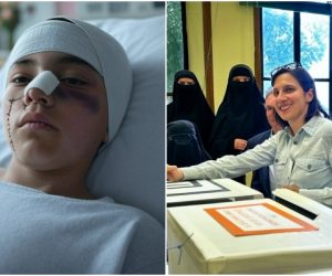 Ragazzino italiano massacrato da 6 immigrati con cittadinanza: 60 giorni di prognosi