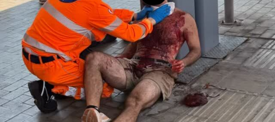Sgozzato dai maranza sul treno: “Non voglio morire” – VIDEO