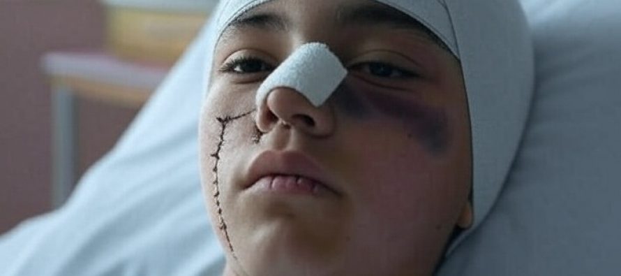 Massacrato da 5 nordafricani: lui perde occhio e loro sono liberi