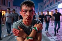 Chiede a 15 immigrati di non devastare la città: lo massacrano e gli distruggono la faccia