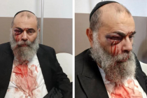 Ebreo massacrato da branco di maranza: “Ti uccidiamo sp*rc* ebreo”