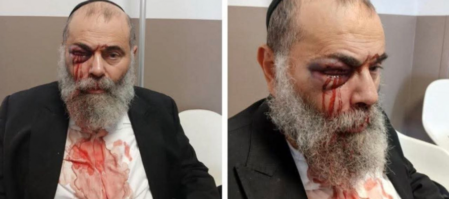 Ebreo massacrato da branco di maranza: “Ti uccidiamo sp*rc* ebreo”