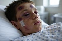 NORDAFRICANI MASSACRANO RAGAZZO DISABILE: MANDIBOLA FRATTURATA