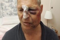 Anziano ridotto così da branco di giovani rom – FOTO