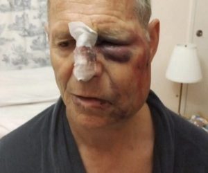 Anziano ridotto così da branco di giovani rom – FOTO