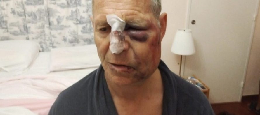 Anziano ridotto così da branco di giovani rom – FOTO