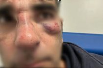 Politico FDI massacrato a calci da immigrato senza biglietto – FOTO