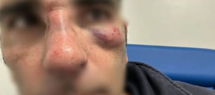 Politico FDI massacrato a calci da immigrato senza biglietto – FOTO