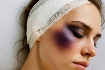 La stupra e le stacca orecchio a Sondrio. Direttore centro accoglienza: «un ragazzo tranquillo»