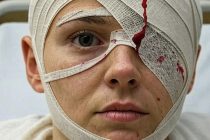 Donna massacrata a Sondrio: africano l’ha sfigurata, ha il volto devastato