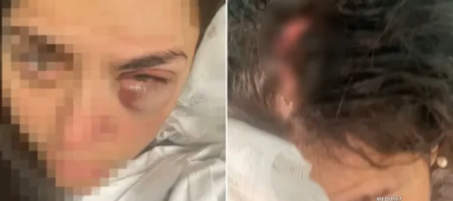 Massacrata da maranza nel quartiere islamico di Milano – VIDEO