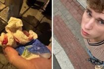 Turista massacrato da maranza davanti ai poliziotti: “Non possiamo fare niente”