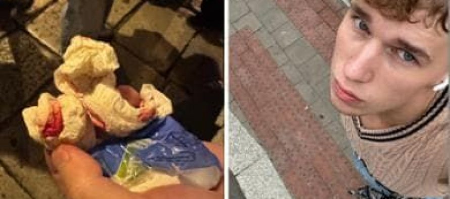 Turista massacrato da maranza davanti ai poliziotti: “Non possiamo fare niente”