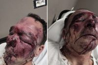 Ridotto così da tre maranza perché passeggia con il cane – FOTO