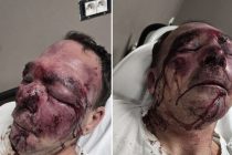 Ridotto così da tre maranza perché passeggia con il cane – FOTO