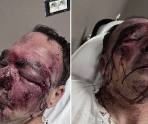 Ridotto così da tre maranza perché passeggia con il cane – FOTO