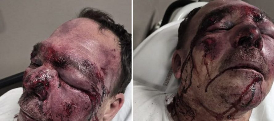 Ridotto così da tre maranza perché passeggia con il cane – FOTO