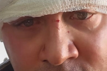 Firenze, capogruppo Lega aggredito da immigrati perché denuncia spacciatori