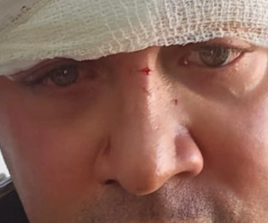 Firenze, capogruppo Lega aggredito da immigrati perché denuncia spacciatori