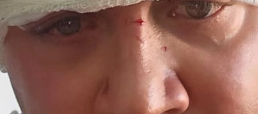 Firenze, capogruppo Lega aggredito da immigrati perché denuncia spacciatori