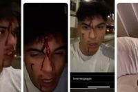 Don Alì, il re dei maranza pestato a sangue a Milano da due italiani – VIDEO