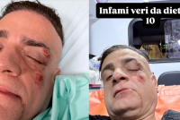 Cicalone aggredito dai borseggiatori in metro a Roma: «In dieci contro uno»