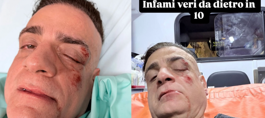 Cicalone aggredito dai borseggiatori in metro a Roma: «In dieci contro uno»