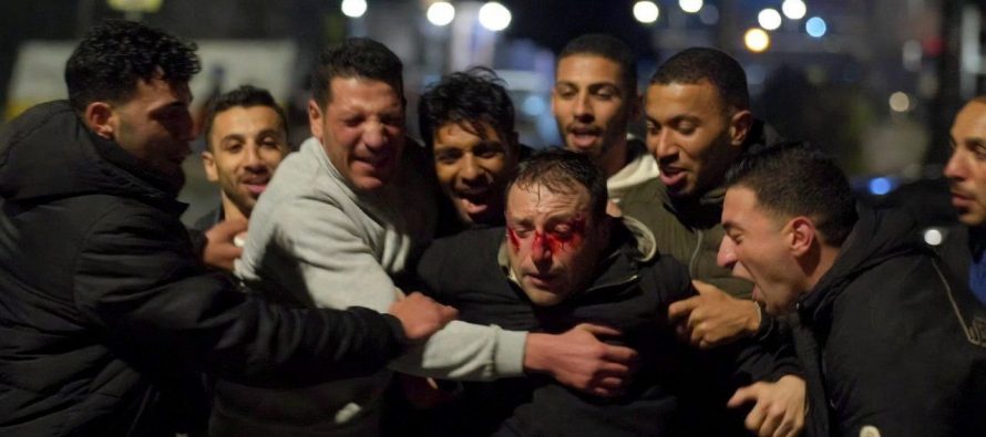 Pestato da 8 nordafricani perché italiano: ragazzo massacrato all’alba