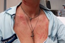 Islamico spoglia e violenta poliziotta: «Le donne vanno sottomesse»