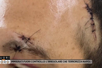 Africano gli conficca coltello in testa ma è libero