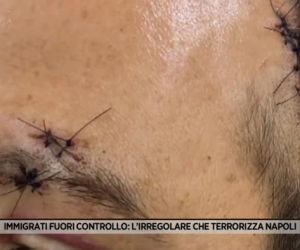 Africano gli conficca coltello in testa ma è libero