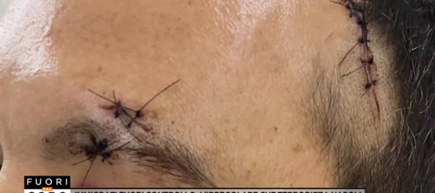 Africano gli conficca coltello in testa ma è libero