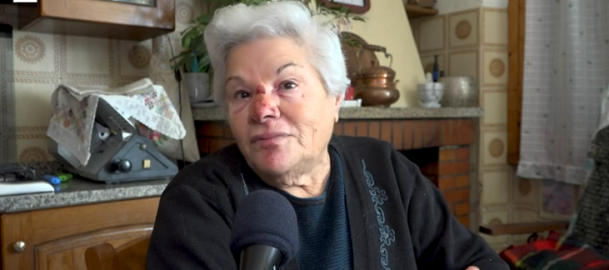 A 83 anni aggredita selvaggiamente da maranza che aveva finto di chiedere aiuto – VIDEO