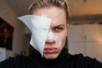 Branco immigrati cerca di cavargli l’occhio a coltellate a Parma