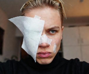 Branco immigrati cerca di cavargli l’occhio a coltellate a Parma