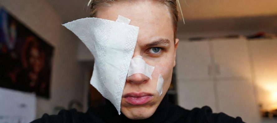 Branco immigrati cerca di cavargli l’occhio a coltellate a Parma