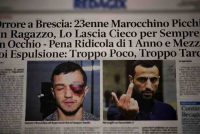 Marocchino Picchia un Ragazzo, Lo Lascia Cieco per Sempre a un Occhio