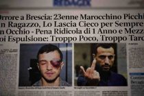 Marocchino Picchia un Ragazzo, Lo Lascia Cieco per Sempre a un Occhio